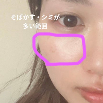 薬用 しみ 集中対策 美容液/メラノCC/美容液を使ったクチコミ(2枚目)