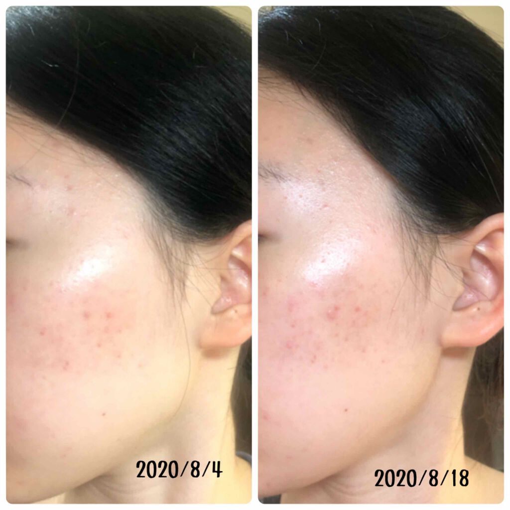 モイストバランス ジェル/ACSEINE/美容液を使ったクチコミ(2枚目)