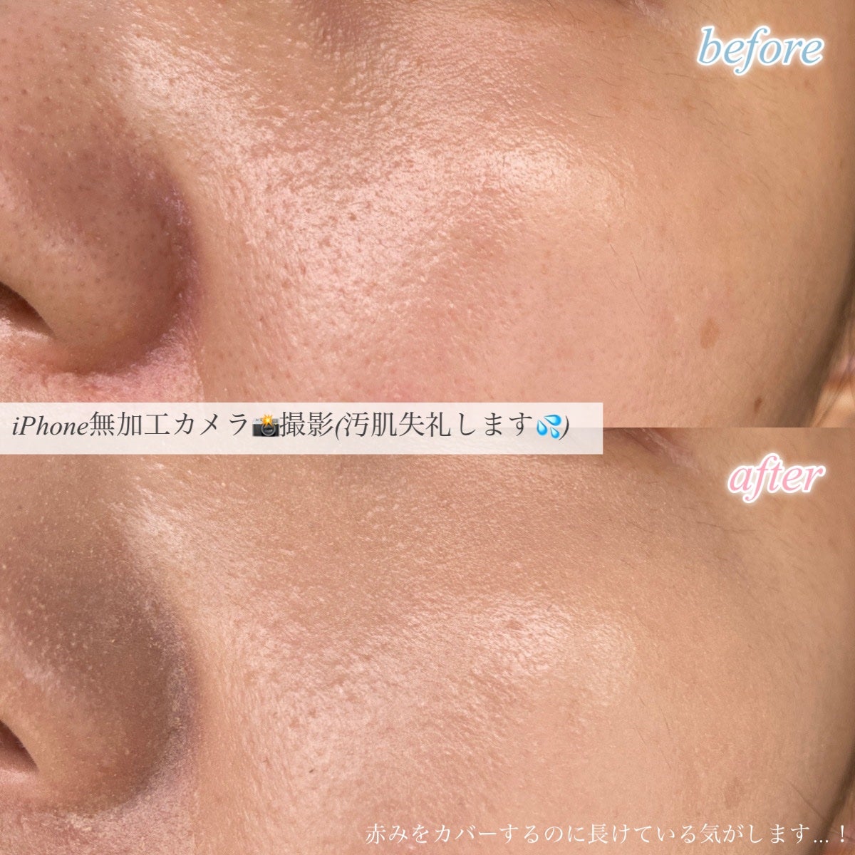 ピンクティーツリーカバーアップグロウクッション/APLIN/クッションファンデーションを使ったクチコミ(4枚目)