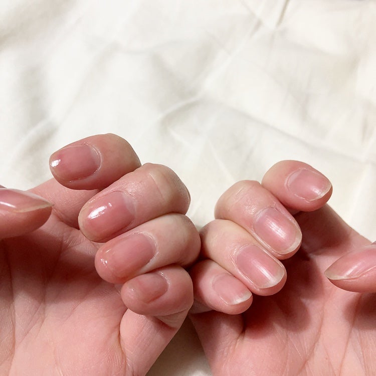 アンドネイルボタニカルクリアコート/BOTANICAL/ネイルオイル・トリートメントを使ったクチコミ(6枚目)