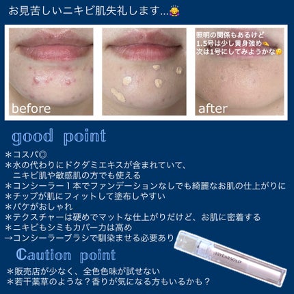 ダーマシンコンシーラー/23years old/リキッドコンシーラーを使ったクチコミ(2枚目)