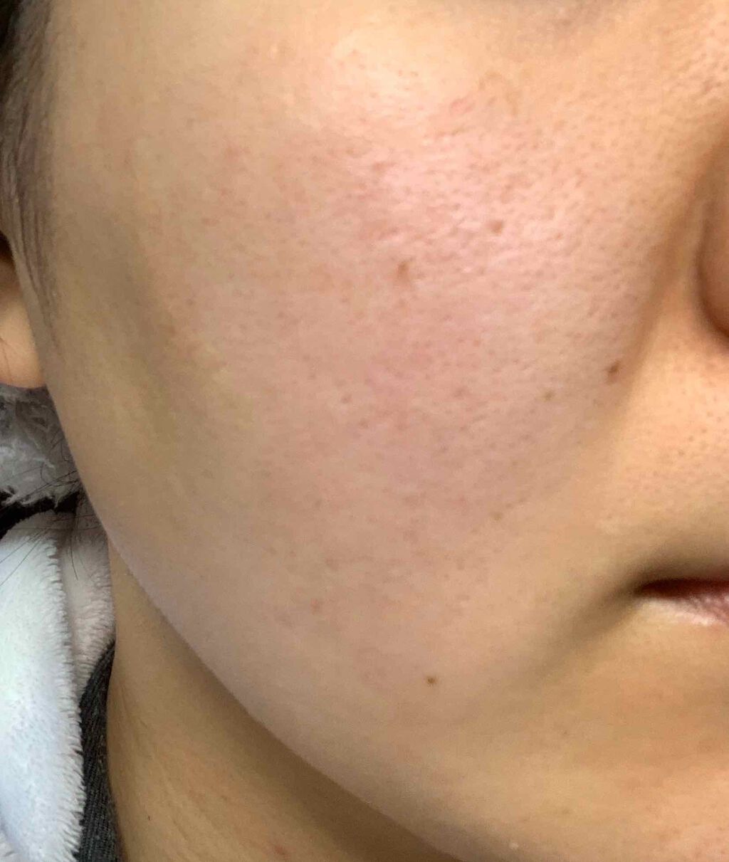 タンイドル ウルトラ ウェア リキッド/LANCOME/リキッドファンデーションを使ったクチコミ（2枚目）