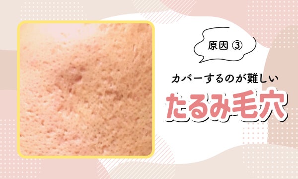 原因③カバーするのが難しいたるみ毛穴