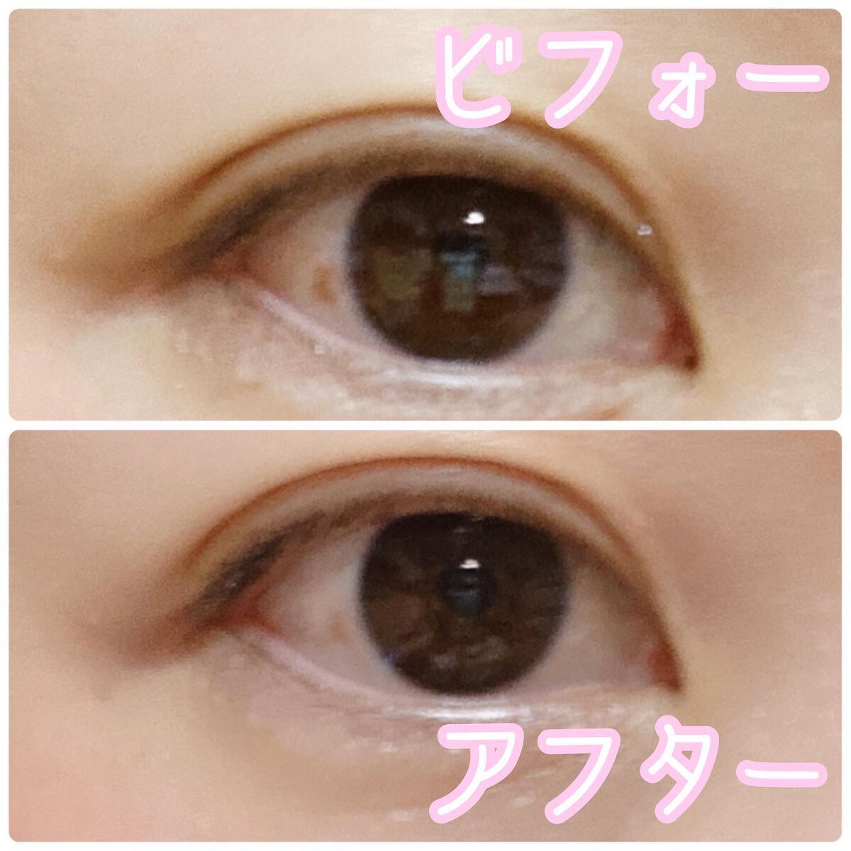 スマイルホワイティエn（医薬品）/ライオン/その他を使ったクチコミ（3枚目）