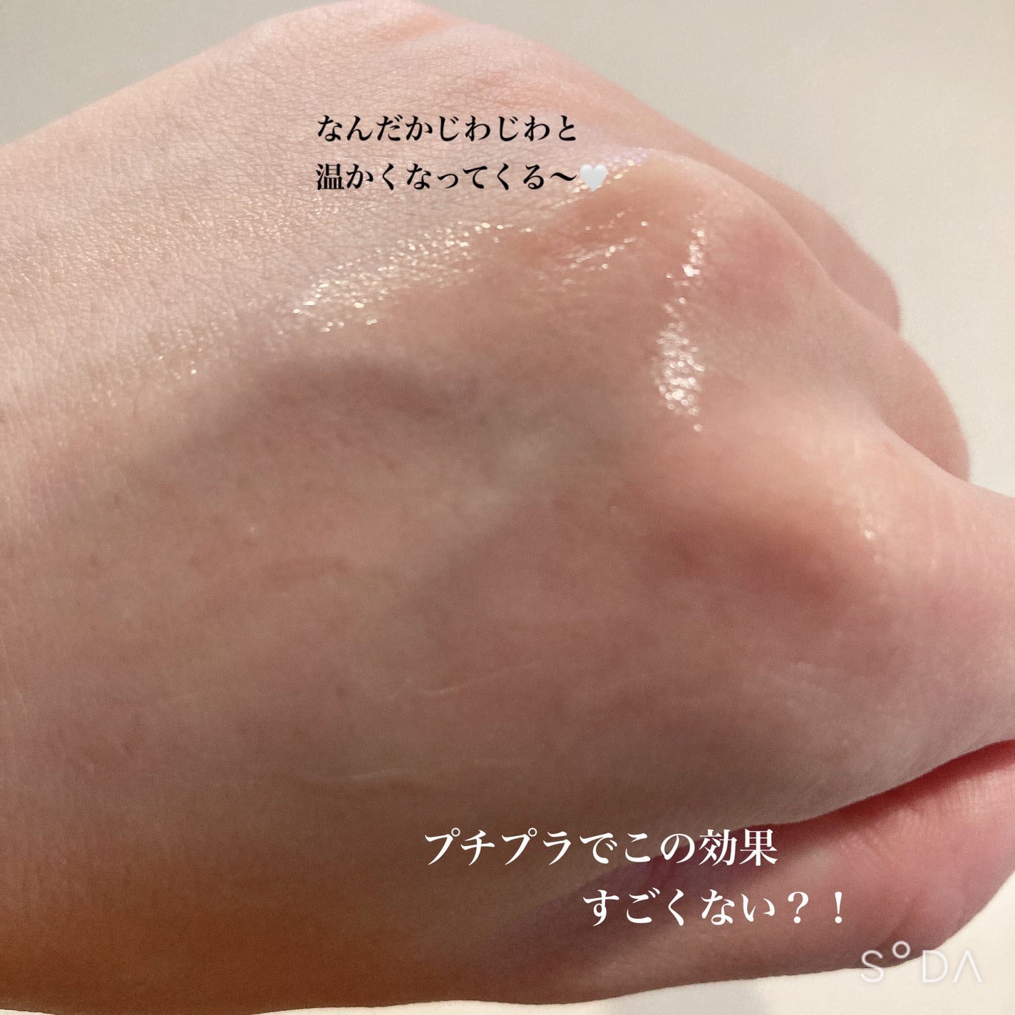 ケアナボーテ VC10 濃美容液/ケアナボーテ/美容液を使ったクチコミ(5枚目)