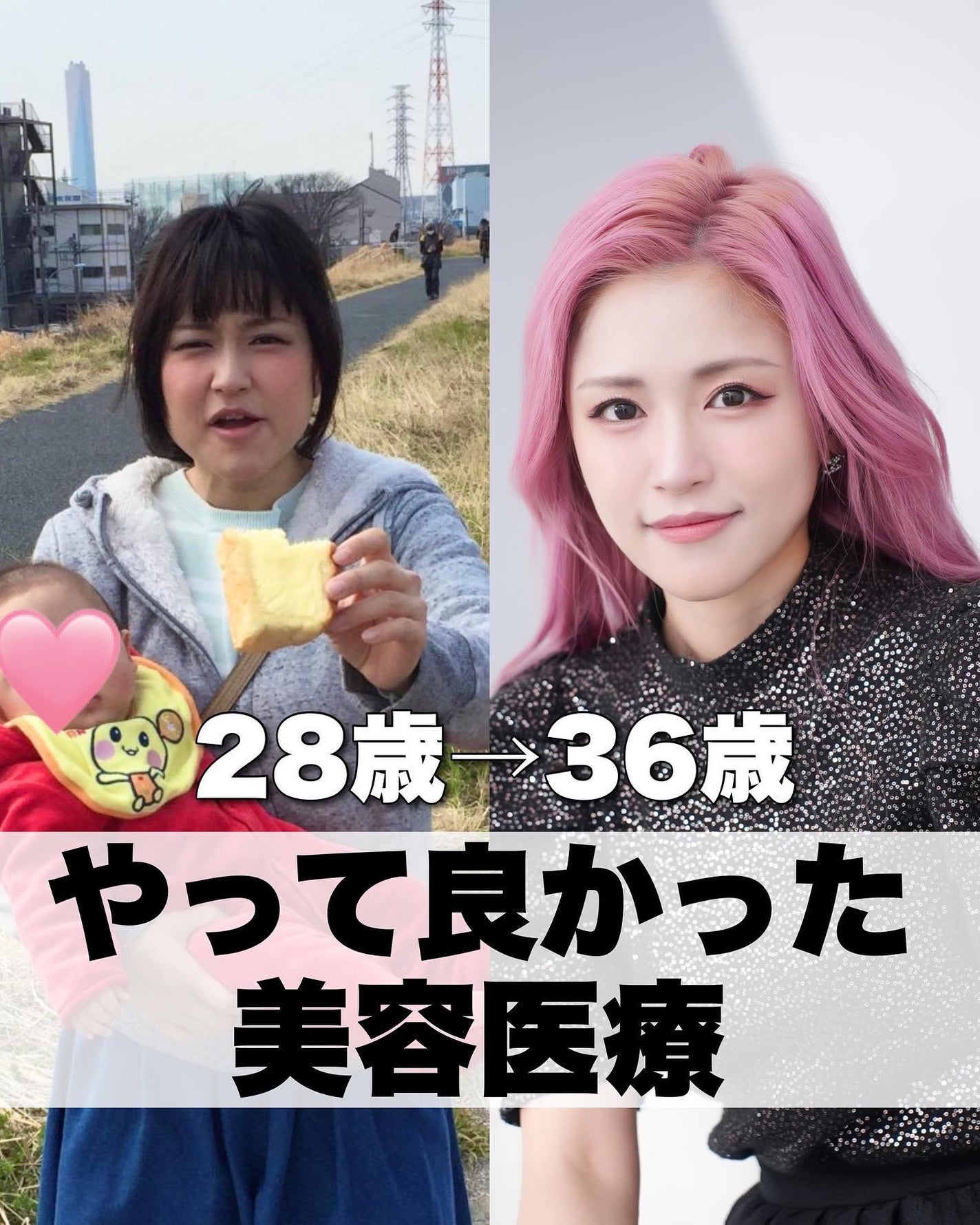 とみりー on LIPS 「36歳がやってよかった美容医療まとめ✨◆───--- - -..」(1枚目)