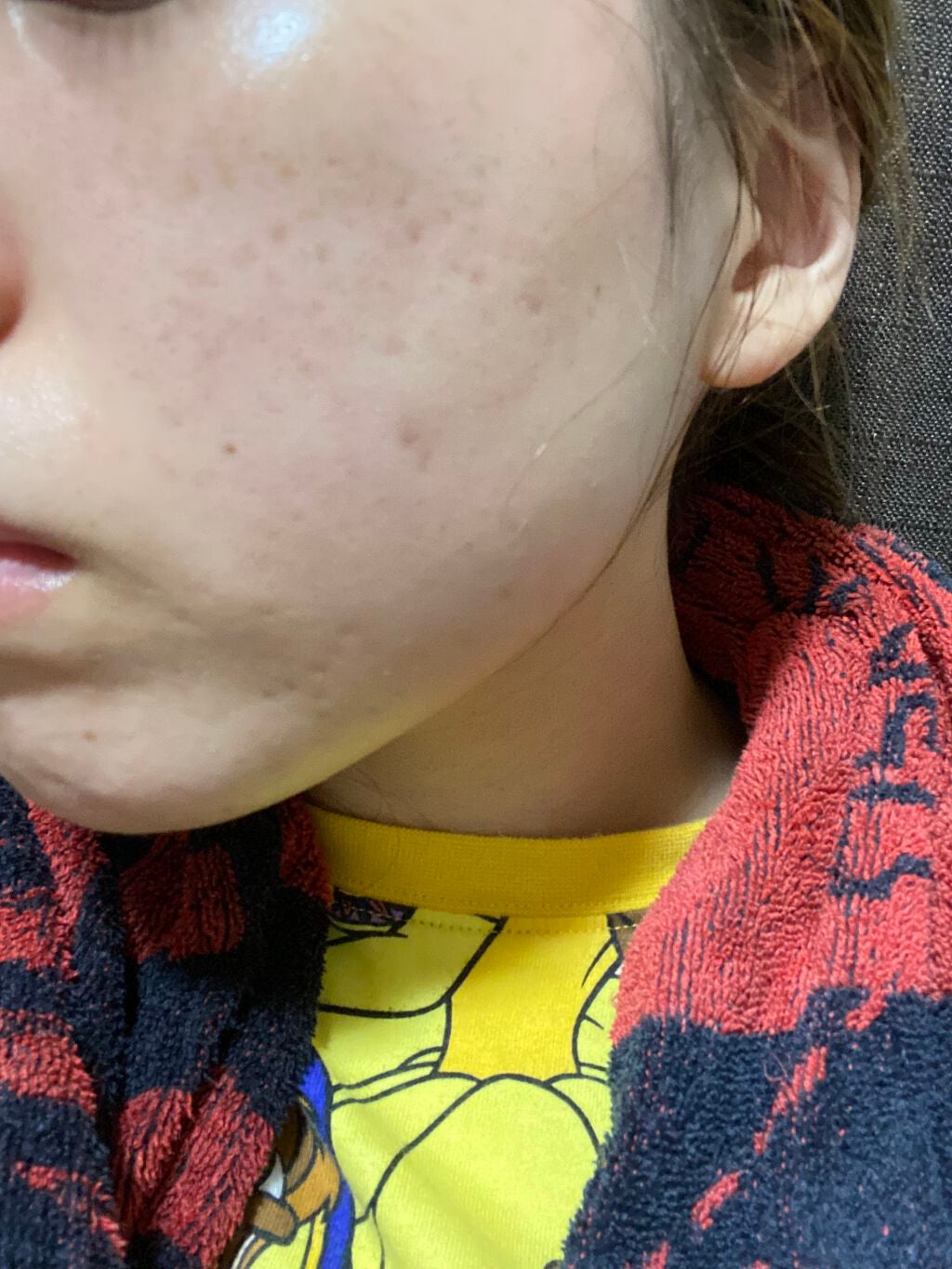 メディカルクリームG(薬用クリームG)/メンターム/ハンドクリームを使ったクチコミ(4枚目)