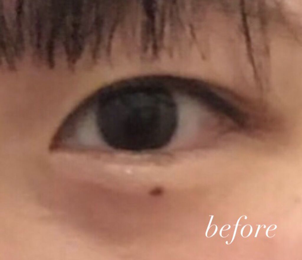 アイトーク/アイトーク/二重まぶた用アイテムを使ったクチコミ（1枚目）