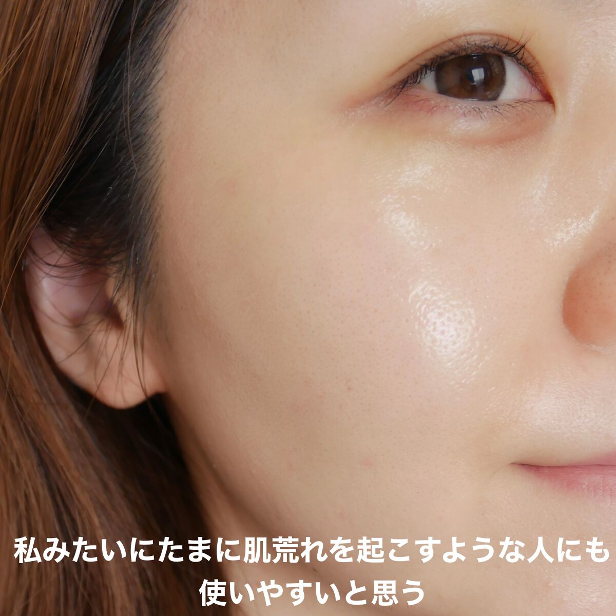 エンリッチプラス 化粧液Ⅱ しっとり <医薬部外品>/ファンケル/化粧水を使ったクチコミ(5枚目)