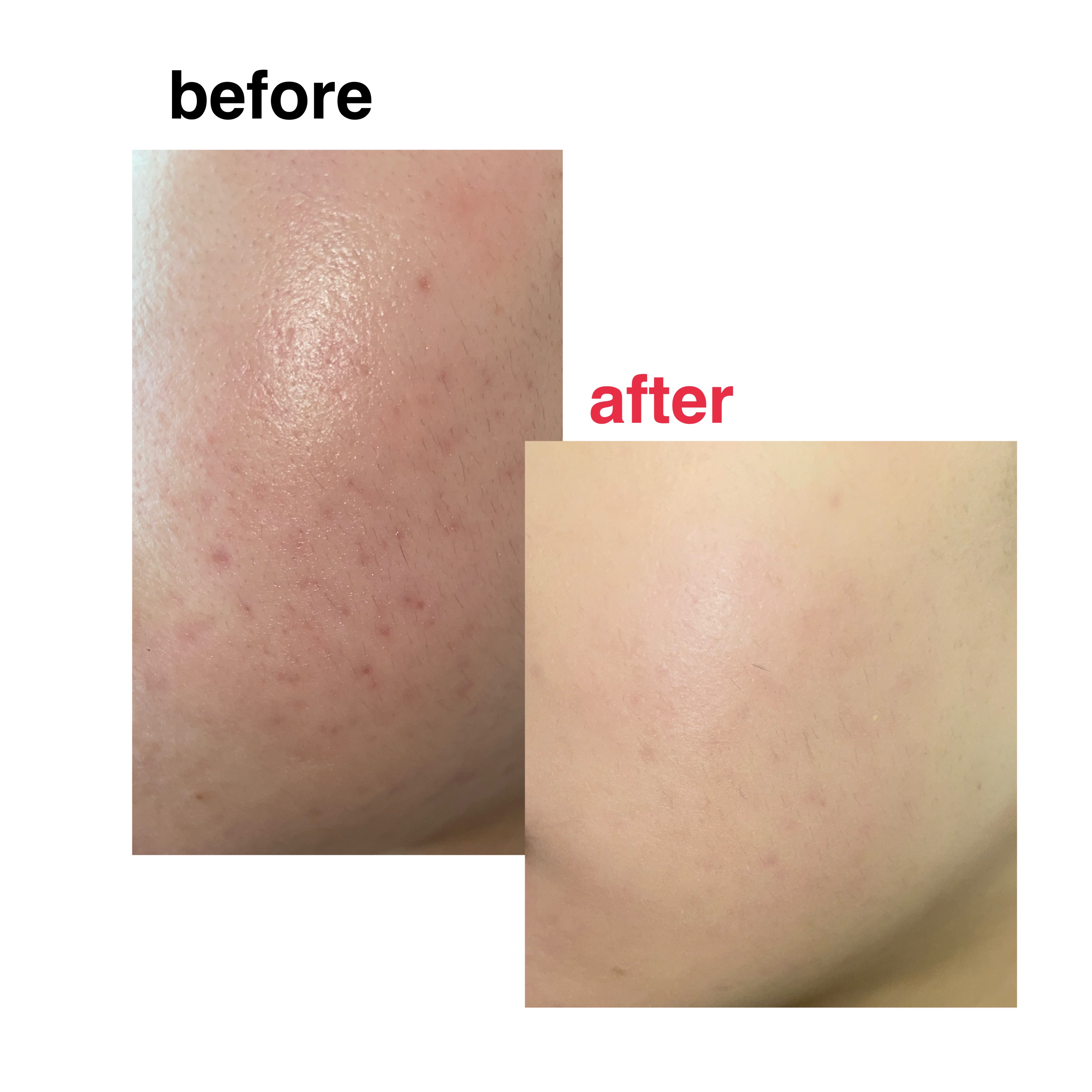 シピシピ フィットスキンクッション/CipiCipi/クッションファンデーションを使ったクチコミ（2枚目）