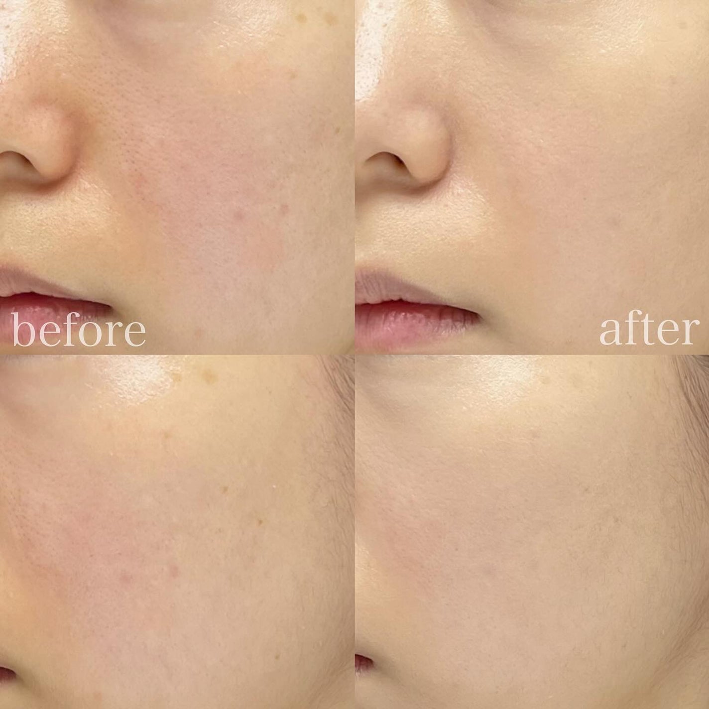 ブラーカバークッション/LUNA/クッションファンデーションを使ったクチコミ(4枚目)