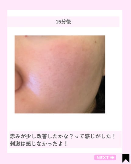 Kana on LIPS 「白玉パッチ♡モッチり肌に/@kana.cosme2525他の投..」(7枚目)