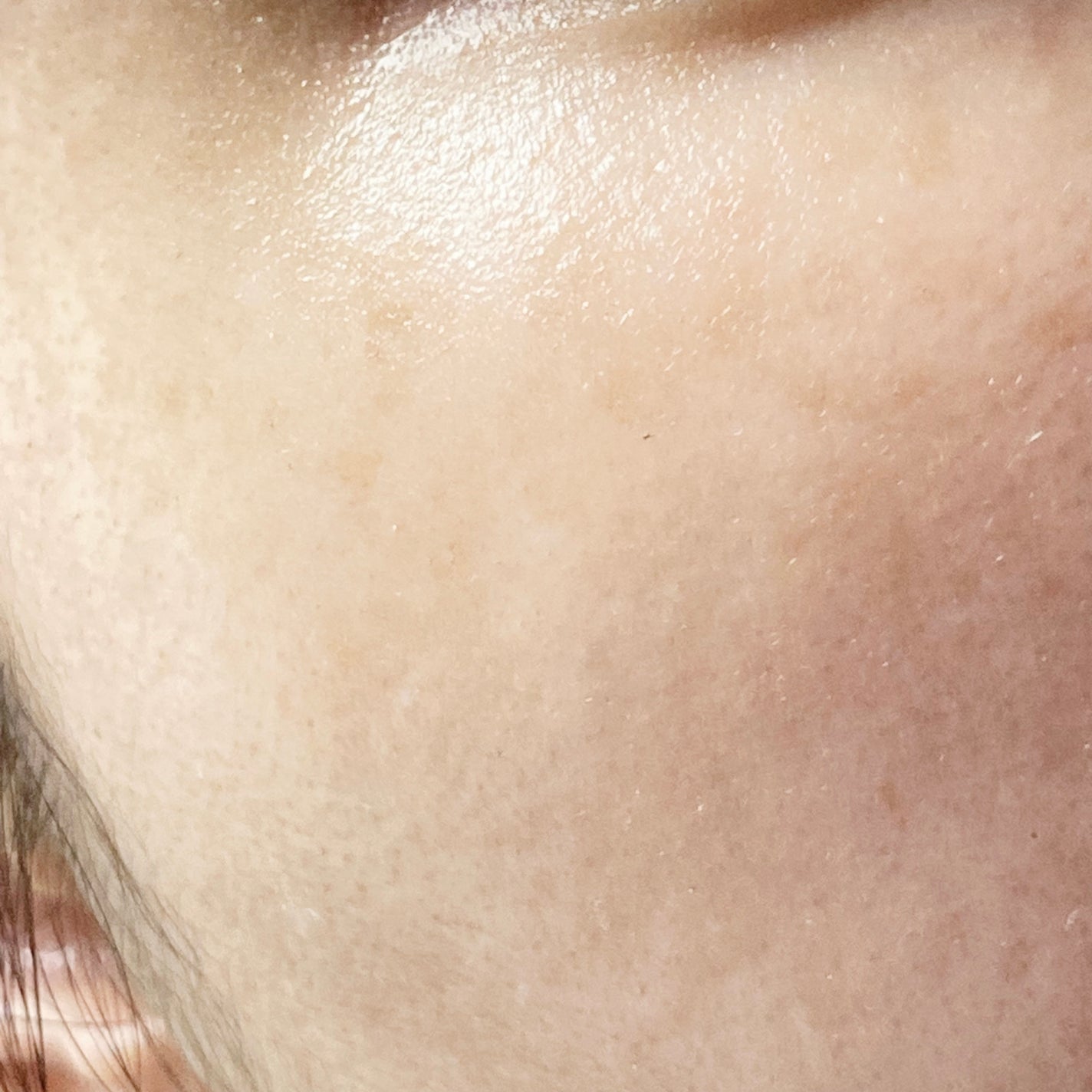 A♡ on LIPS 「施術を受けて5日が経ちました!ルメッカですが、私の場合は濃く反..」(3枚目)