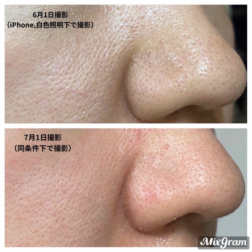 R.N.A. パワー ラディカル ニュー エイジ/SK-II/乳液を使ったクチコミ（3枚目）