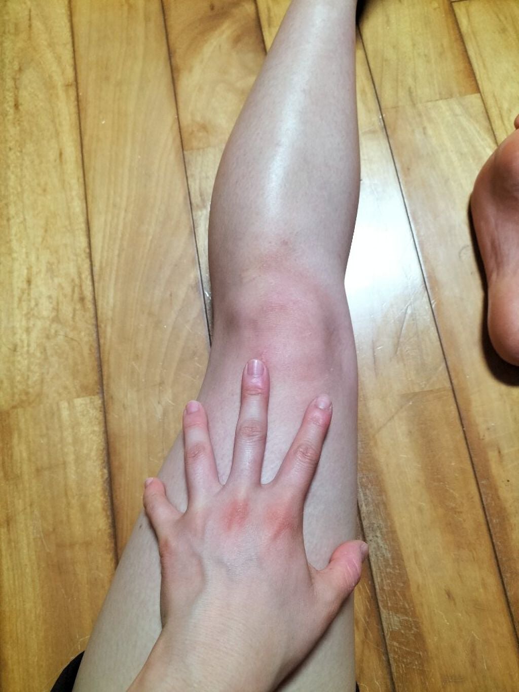 momo ෆ on LIPS 「ひなちゃんねる様の脚やせ動画5日目。連日お見苦しい脚ばかりで申..」(3枚目)