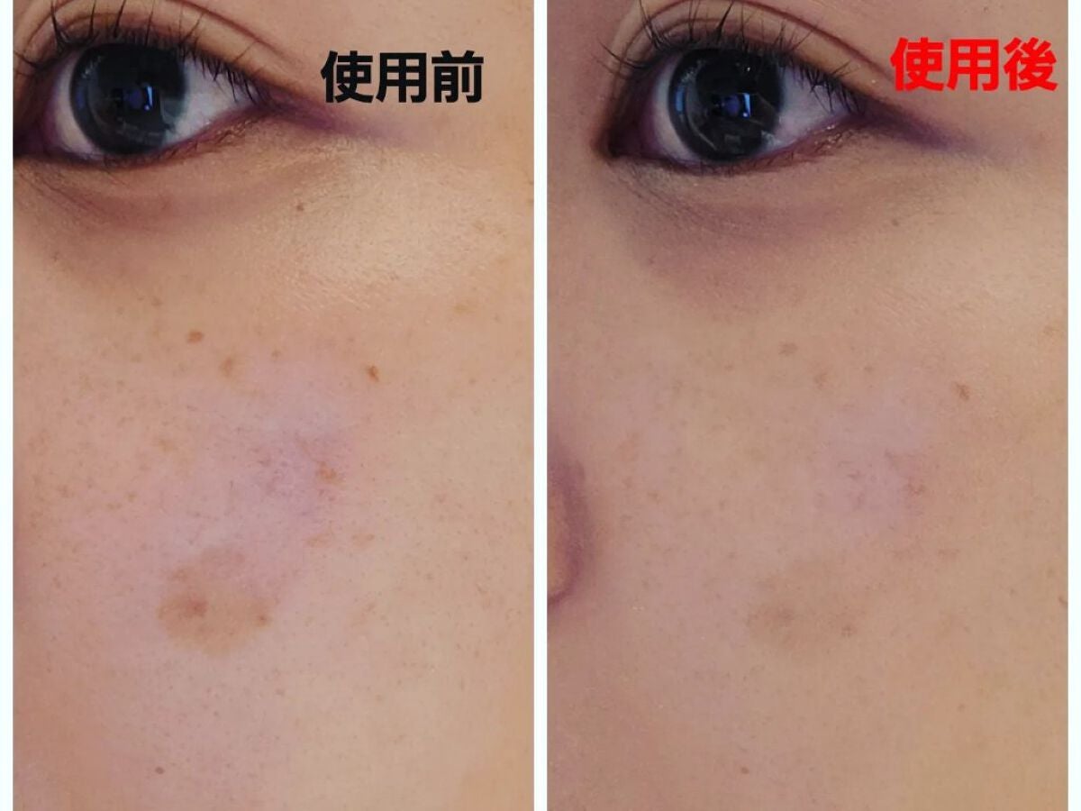 アルーチェルーチェ クッションファンデーション/Aluce luce/クッションファンデーションを使ったクチコミ(5枚目)