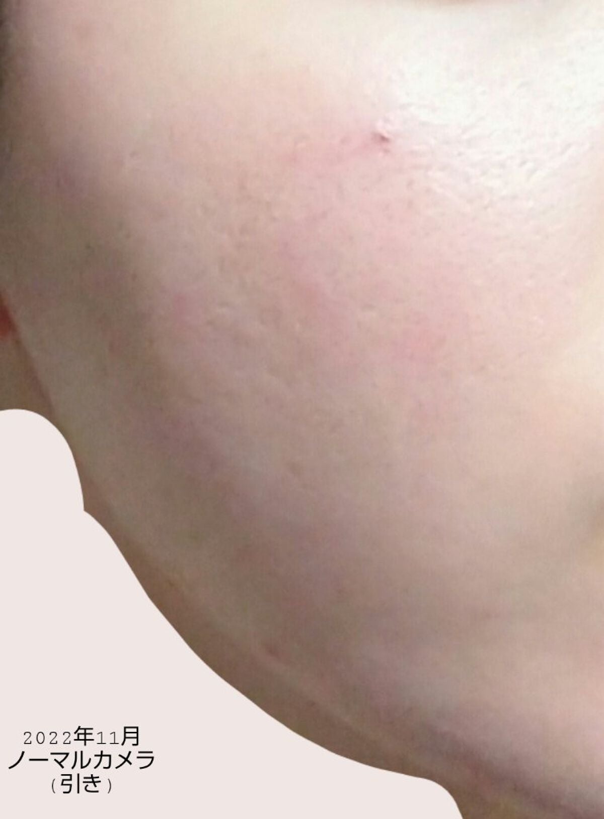 スマートセット/プロアクティブ/スキンケアキットを使ったクチコミ(4枚目)