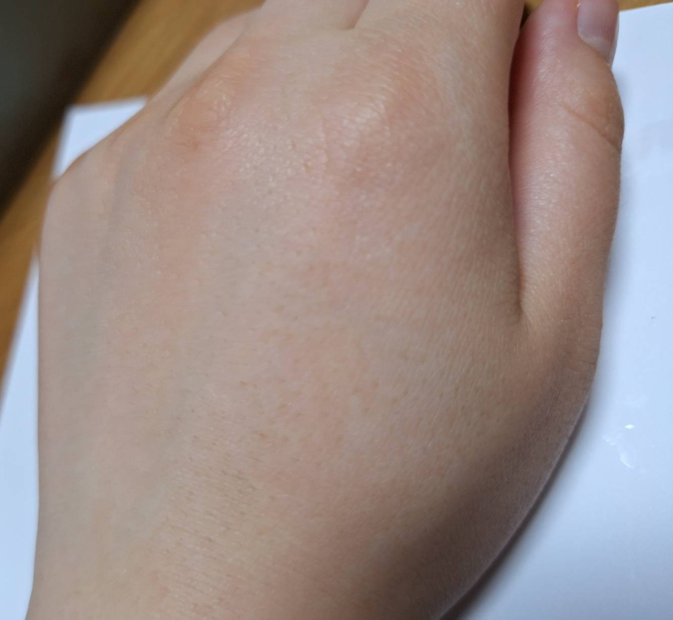 センテラ アンプル/SKIN1004/美容液を使ったクチコミ（2枚目）