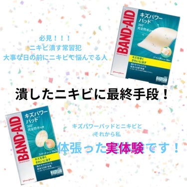 
誠に勝手ながら最近忙しく更新頻度が落ちていて申し訳ないです😓

今日はニキビ潰しちゃう人必見！
潰しちゃった時の最後の手段をご紹介します！


私は大学生になるまでほとんどニキビができたことありません