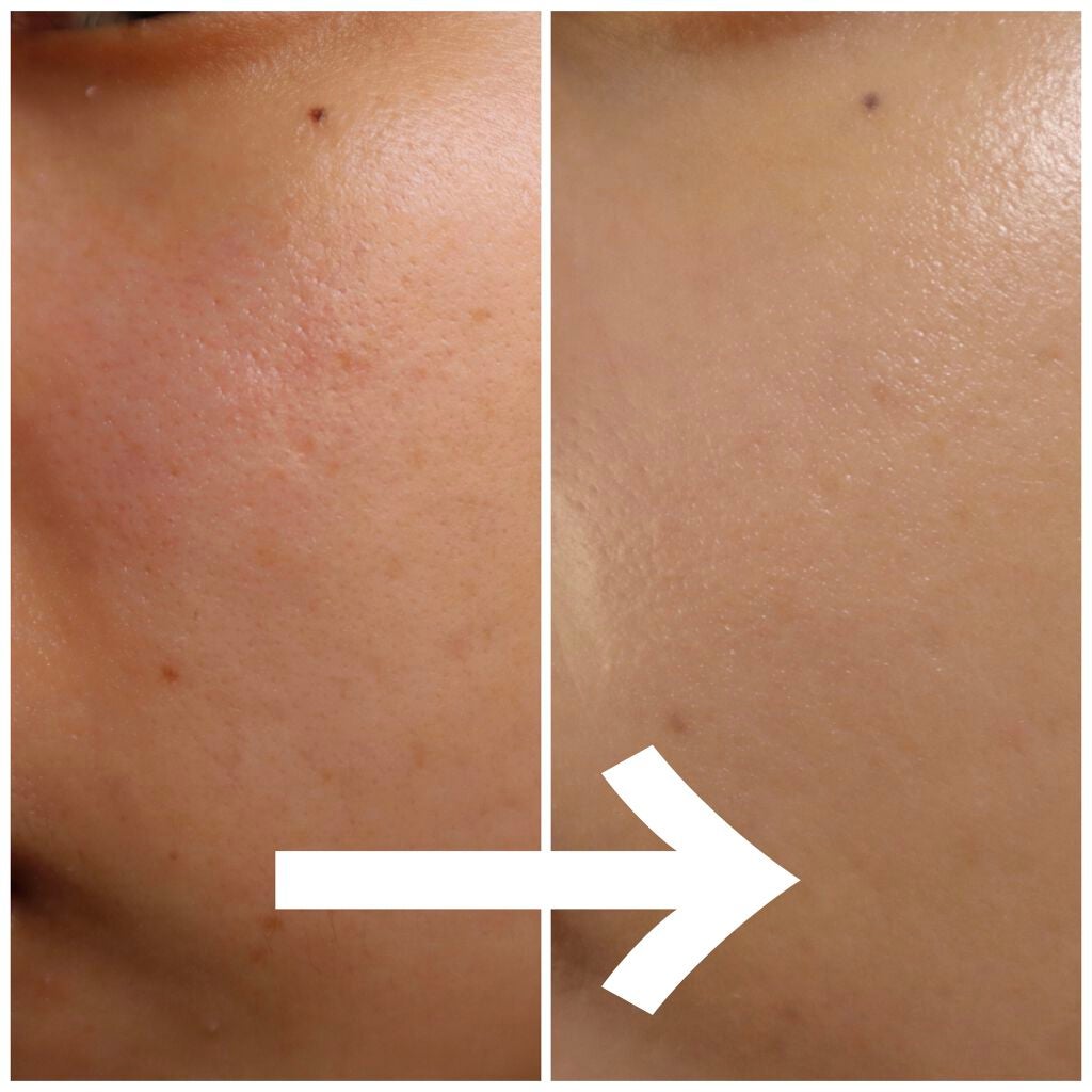 UVイデア XL プロテクショントーンアップ/ラ ロッシュ ポゼ/日焼け止めクリームを使ったクチコミ(2枚目)