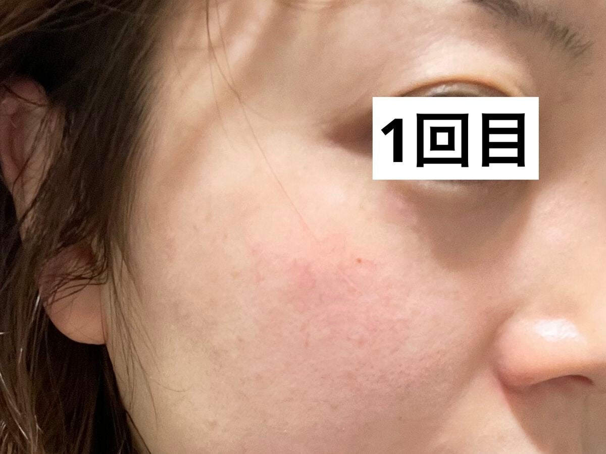 ももぷり フレッシュピールオフパック/ももぷり/ピーリングを使ったクチコミ(2枚目)