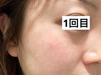 ももぷり フレッシュピールオフパック/ももぷり/ピーリングを使ったクチコミ(2枚目)