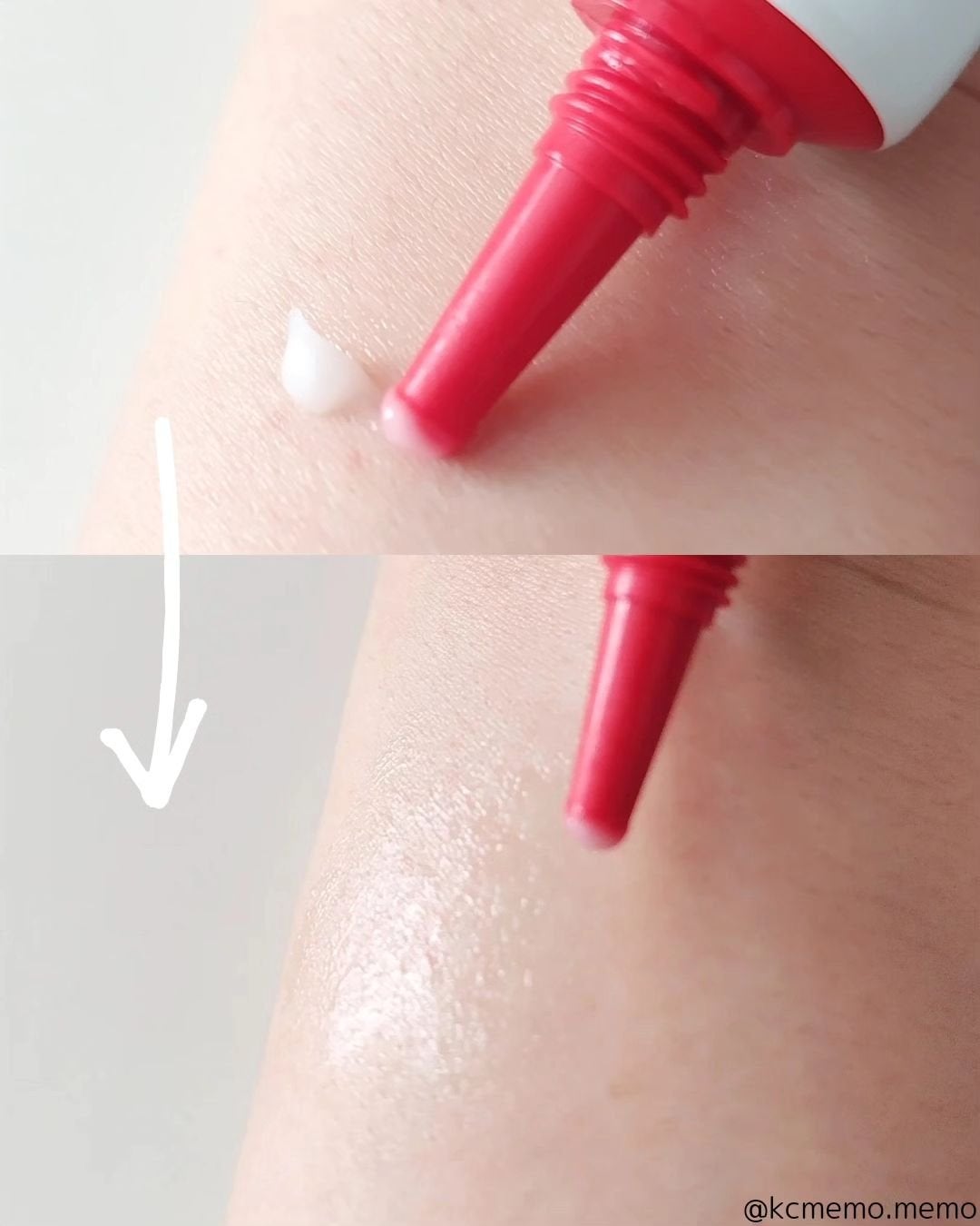 エーキュアスピキュールスポット/obsero/フェイスクリームを使ったクチコミ(5枚目)