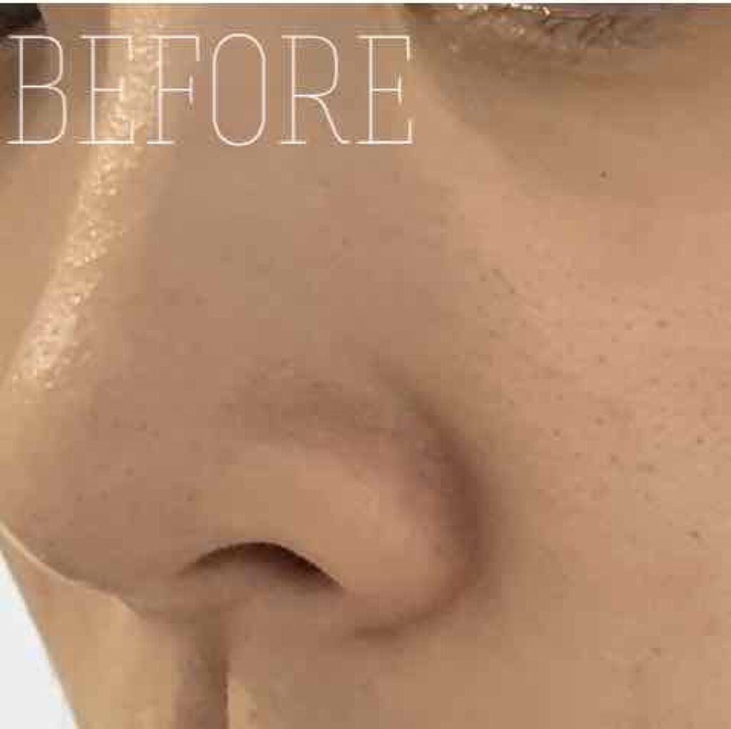 オバジC25セラムNEO/オバジ/美容液を使ったクチコミ（3枚目）