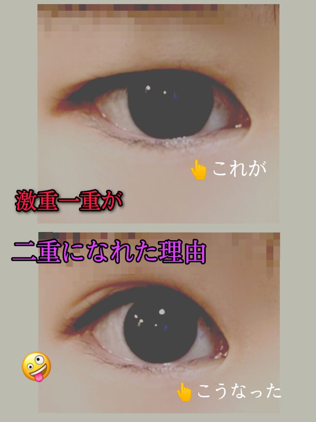 アイテープ 埋没式両面テープ/DAISO/二重まぶた用アイテムを使ったクチコミ（1枚目）