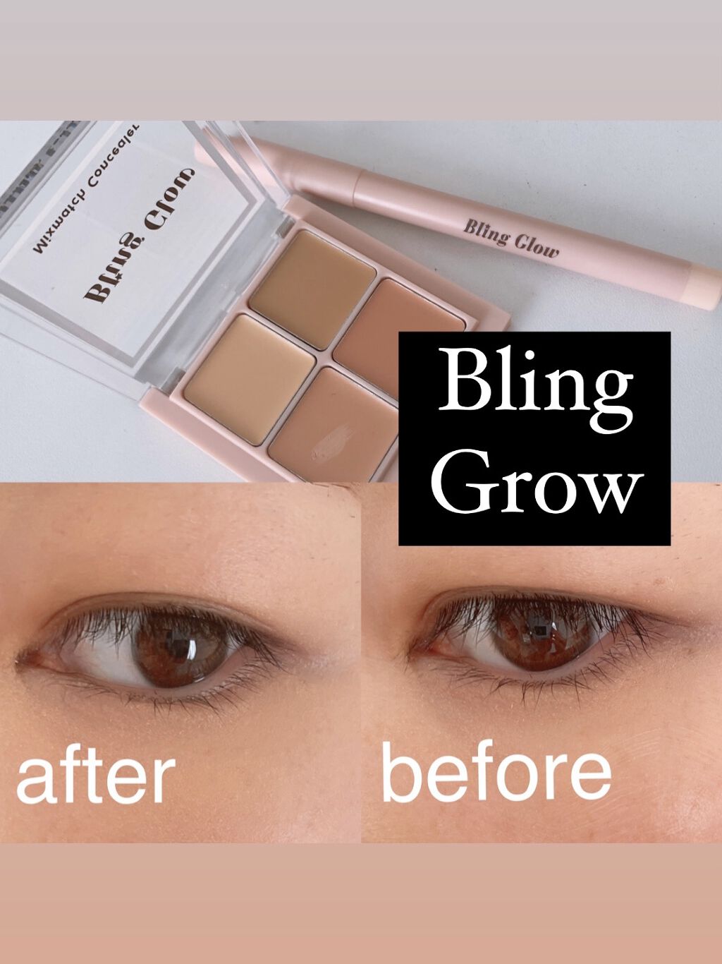ミックスマッチコンシーラー/BLING GLOW/パレットコンシーラーを使ったクチコミ（1枚目）