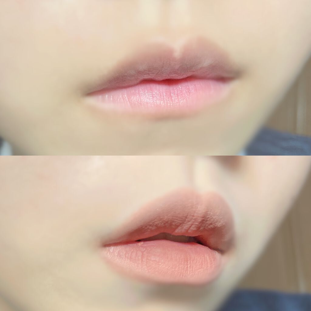 薬用固形パウダー/ピジョン/ボディパウダーを使ったクチコミ（2枚目）