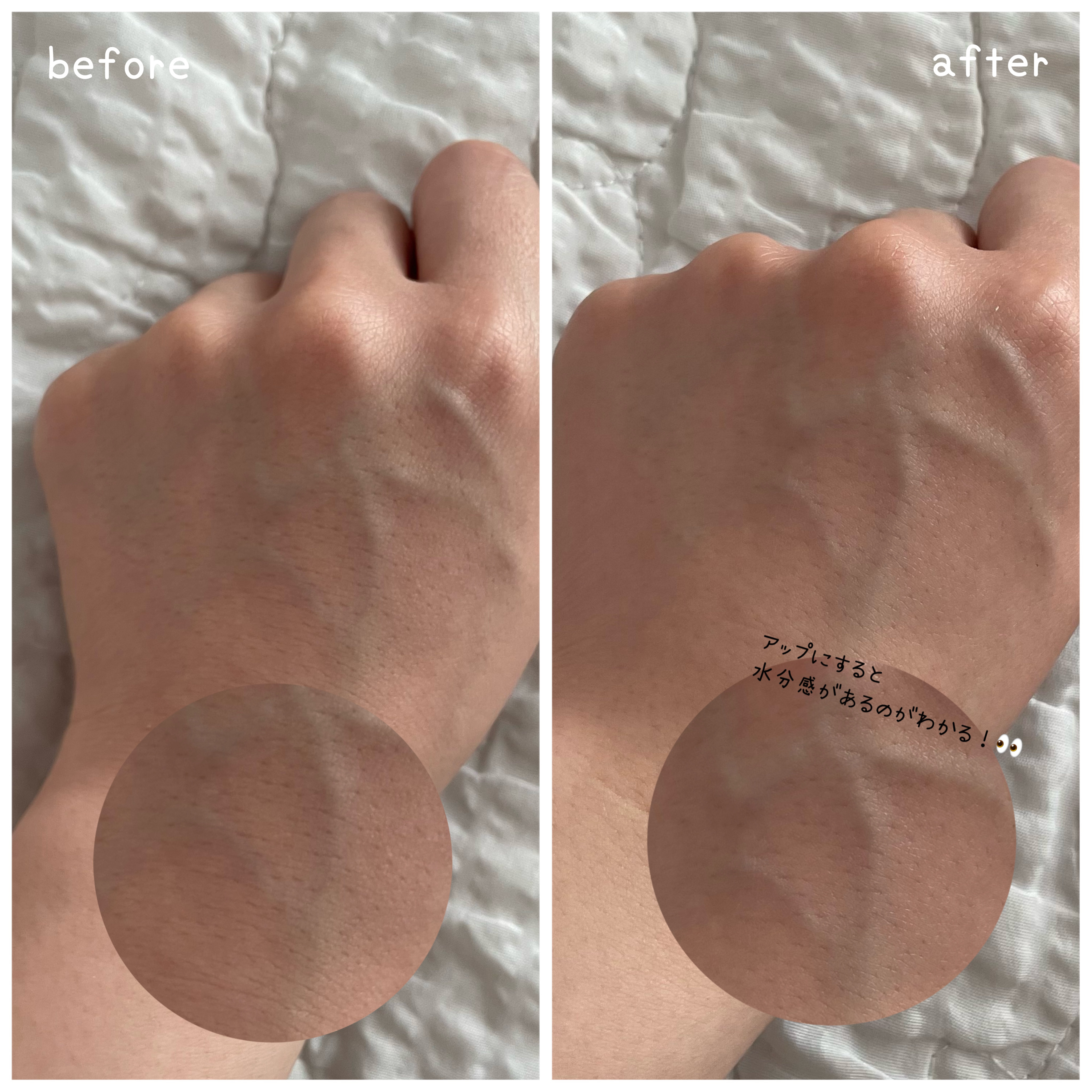 シカリニック PSL クリーム/CICALINIC/フェイスクリームを使ったクチコミ（3枚目）