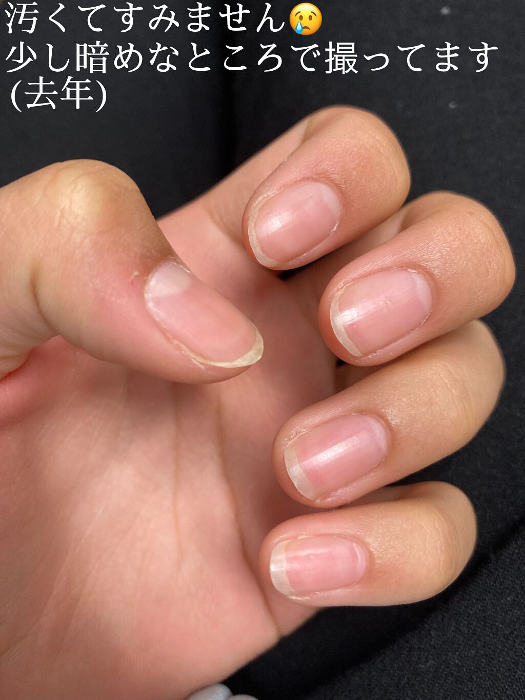 ネイルケアオイル/無印良品/ネイルオイル・トリートメントを使ったクチコミ(8枚目)