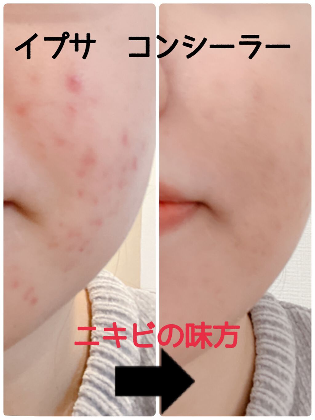 クリエイティブコンシーラーe/IPSA/パレットコンシーラーを使ったクチコミ(1枚目)