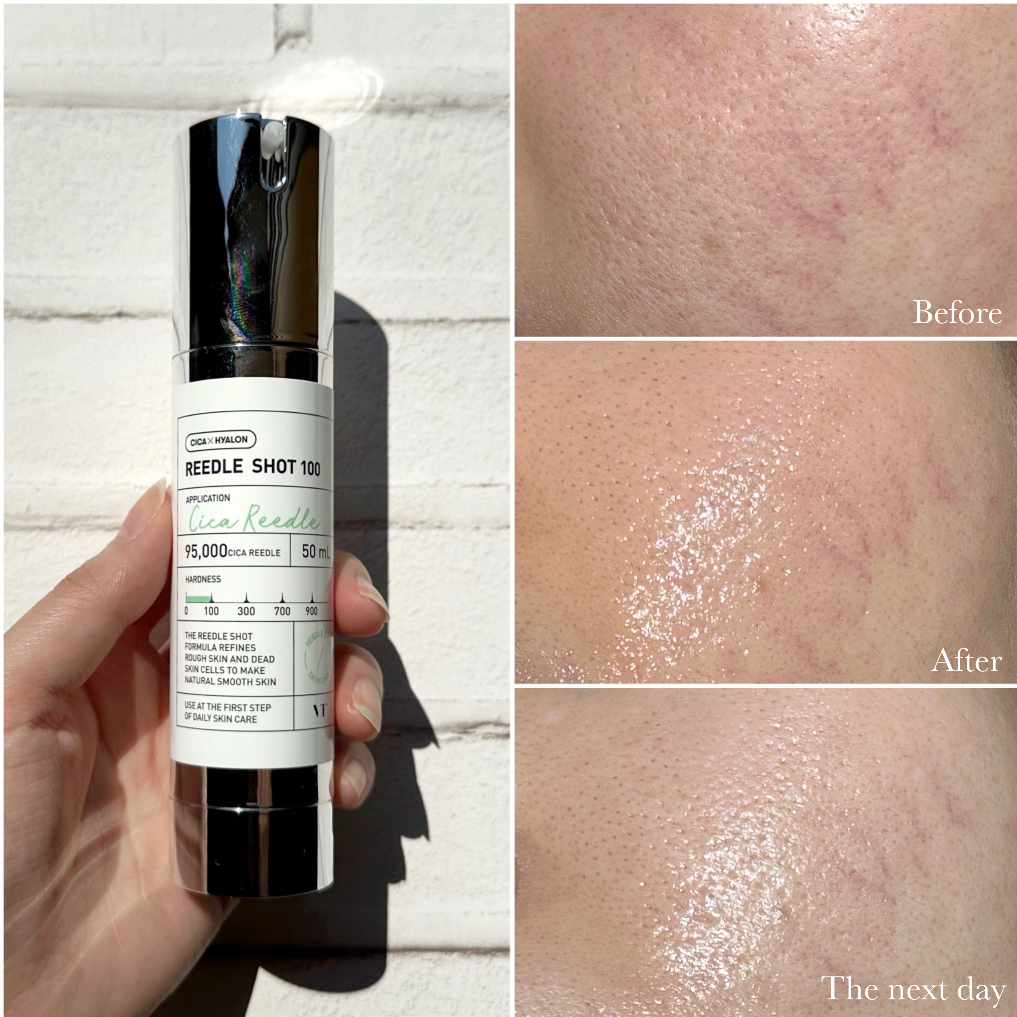 シカレチA エッセンス0.1/VT/美容液を使ったクチコミ（3枚目）