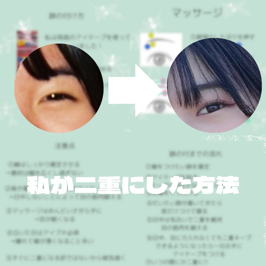 みなさんこんにちは！

今回は「私が二重にして方法」を教えていこうと思います

私は元々片目二重でもう片目一重というアンバランス

なのが気になって二重にしようと思いました

実際にここ1年アイプチをしなくても二重のままなので

どうやった