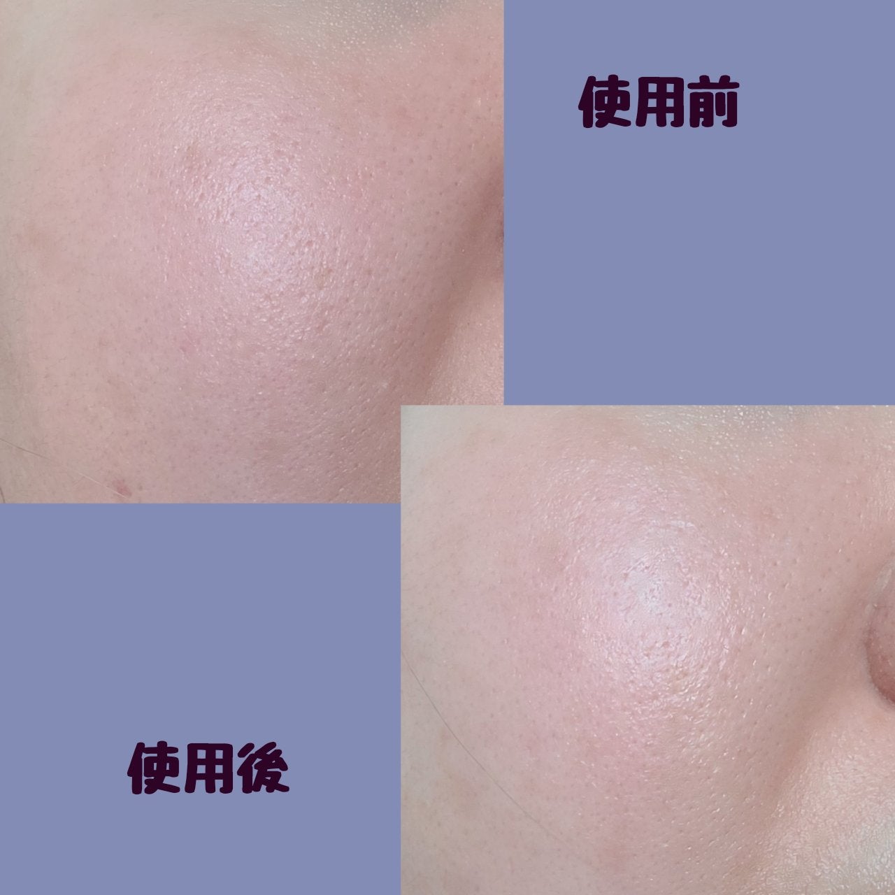 チハヤ on LIPS 「HANYULのピュアアルテミシアハイドレーディングカーミングト..」(4枚目)