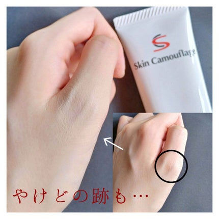 マーシュフィールド SC ボディカバーファンデN/マーシュ・フィールド/クリーム・エマルジョンファンデーションを使ったクチコミ(7枚目)