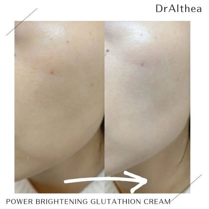 パワーブライトニング グルタチオンクリーム/Dr.Althea/フェイスクリームを使ったクチコミ(5枚目)