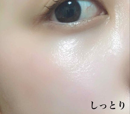 オールインワンジェル 発酵ヒアルロン酸原液美容液セット/BIOPREMIUM/スキンケアキットを使ったクチコミ(8枚目)