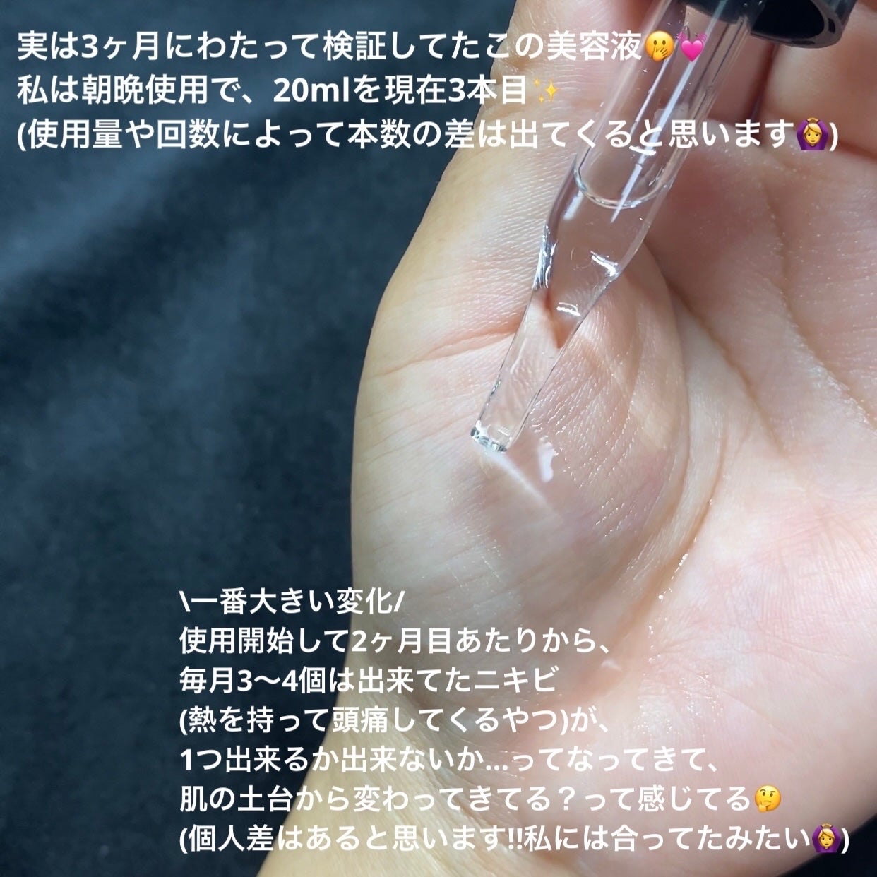 Cエッセンス VC5+PLUS /EBiS化粧品/美容液を使ったクチコミ(3枚目)