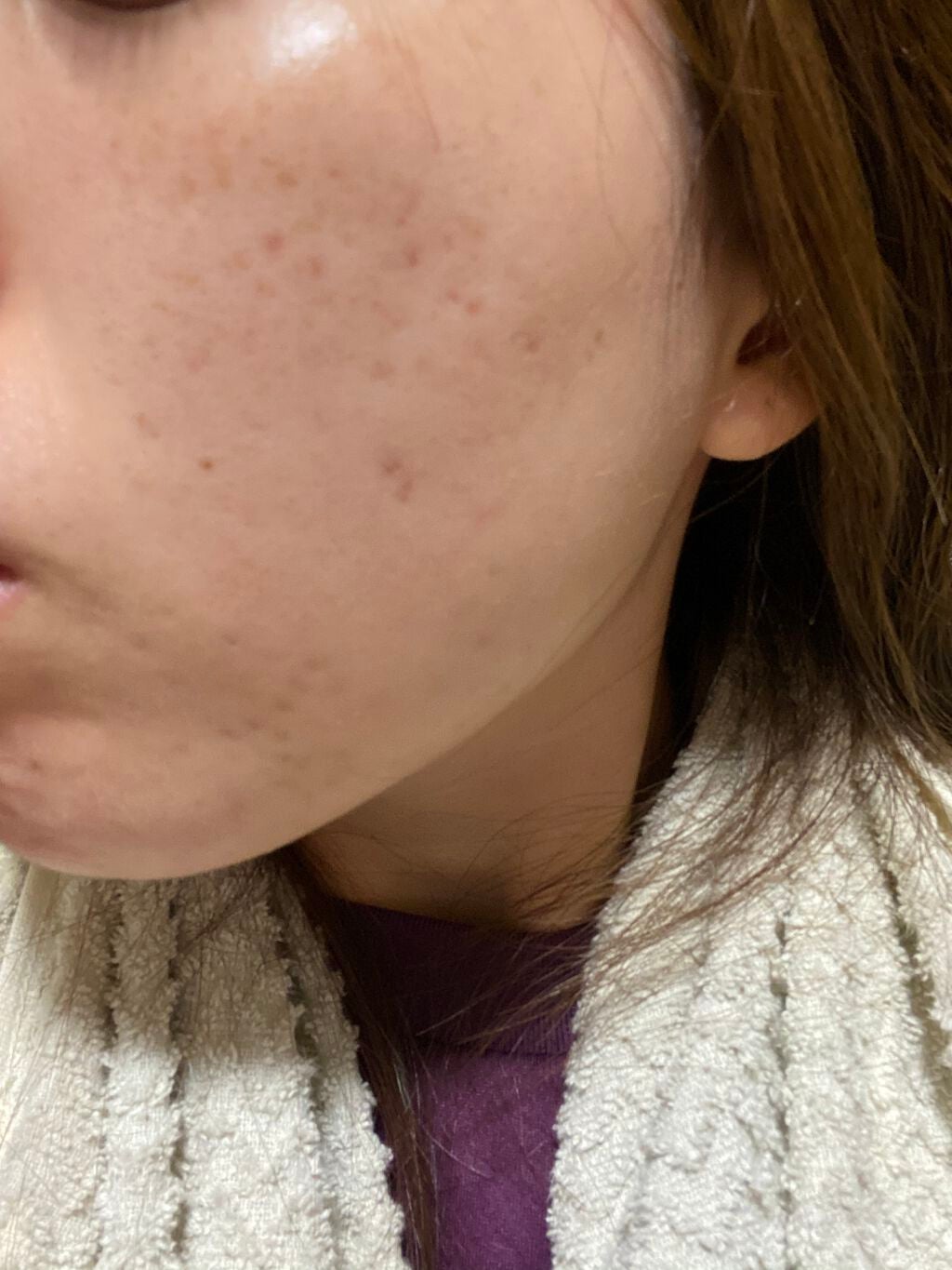 メディカルクリームG(薬用クリームG)/メンターム/ハンドクリームを使ったクチコミ(4枚目)