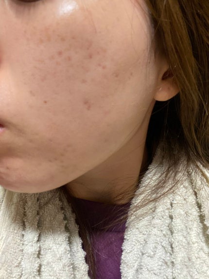 メディカルクリームG(薬用クリームG)/メンターム/ハンドクリームを使ったクチコミ(4枚目)