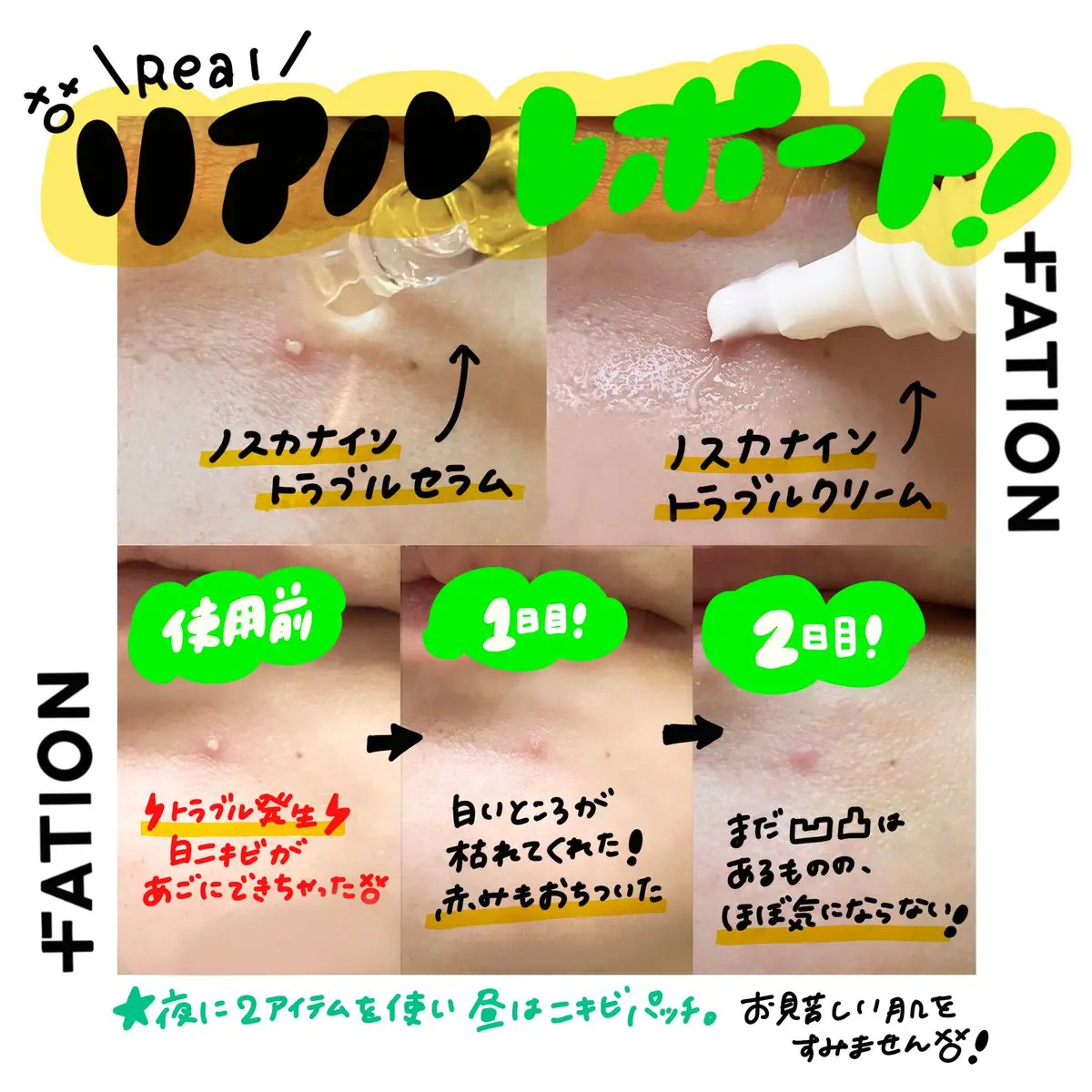 ノスカナイン トラブル セラム/FATION/美容液を使ったクチコミ（3枚目）