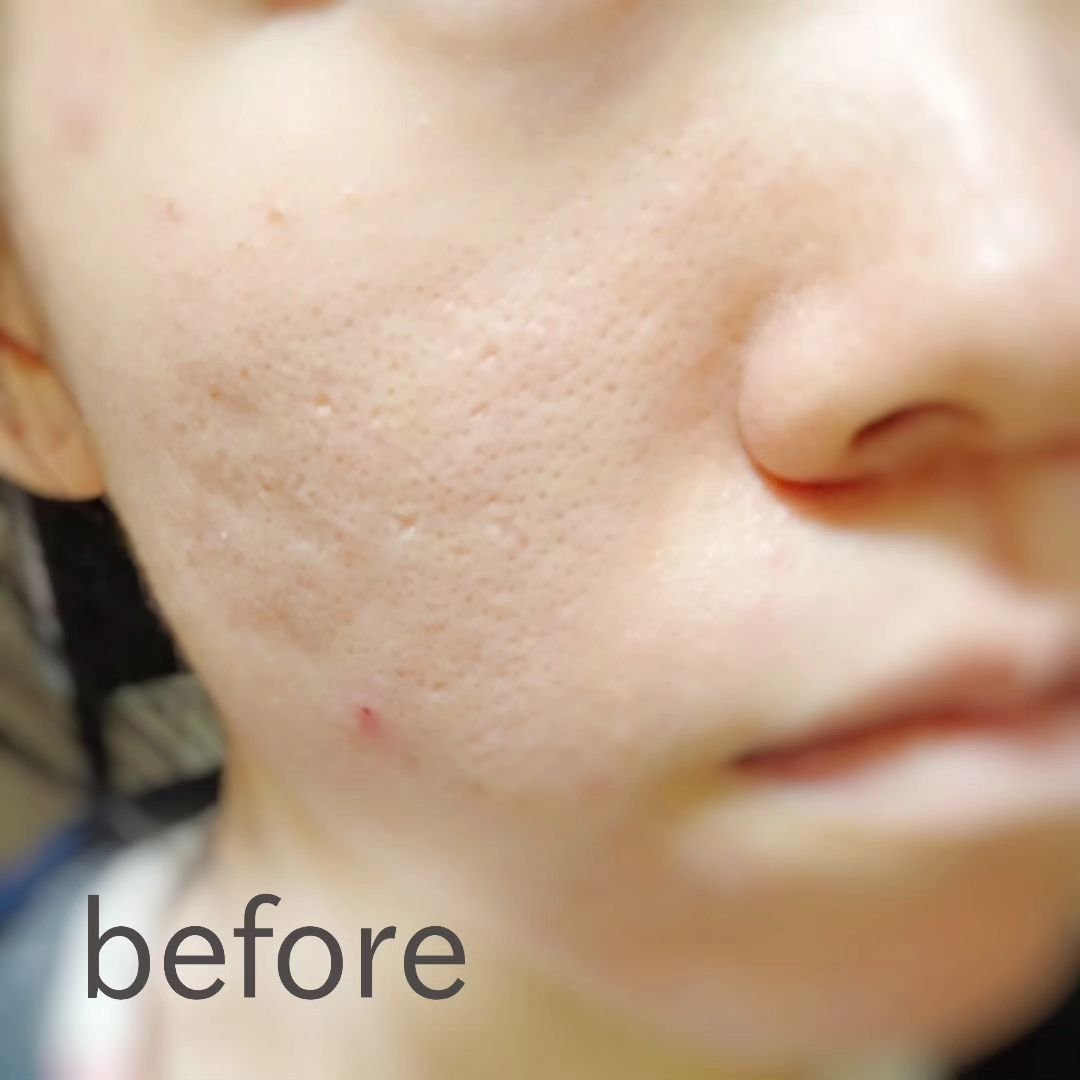 ピクジェリークセラムパウダリーBB-SP/Pesca(ペスカ)/パウダーファンデーションを使ったクチコミ（3枚目）