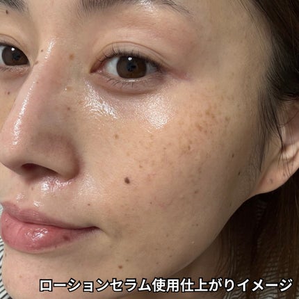 ディセンシア つつむ ローションセラム E/DECENCIA/化粧水を使ったクチコミ(6枚目)