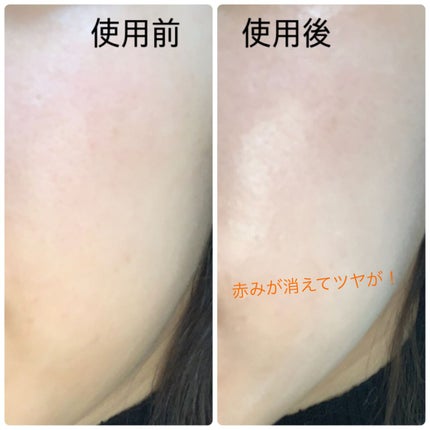 ピーチスキンフィッティングベース/espoir/化粧下地を使ったクチコミ(3枚目)