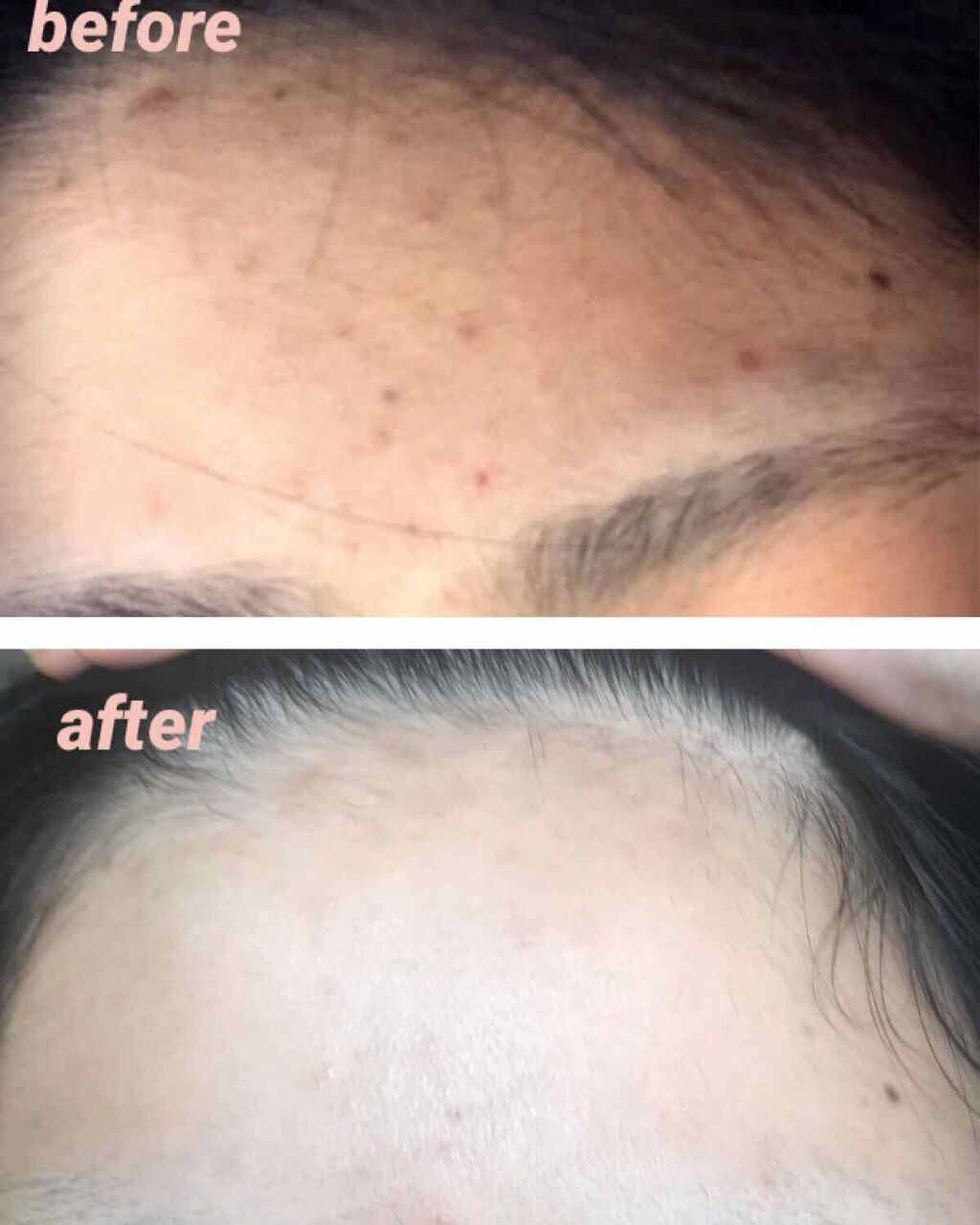 明色美顔水 薬用化粧水/美顔/化粧水を使ったクチコミ(3枚目)