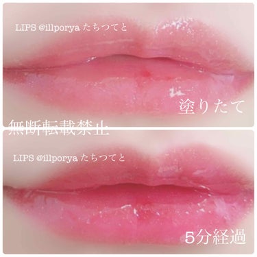 ETUDE プランピングパールシロップのクチコミ「2枚目に唇の写真あります！

ETUDE HOUSE
エチュードハウス

Plumping P.....」（2枚目）