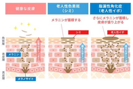 ミルクブライトニングトナー/MEDIHEAL/化粧水を使ったクチコミ(4枚目)